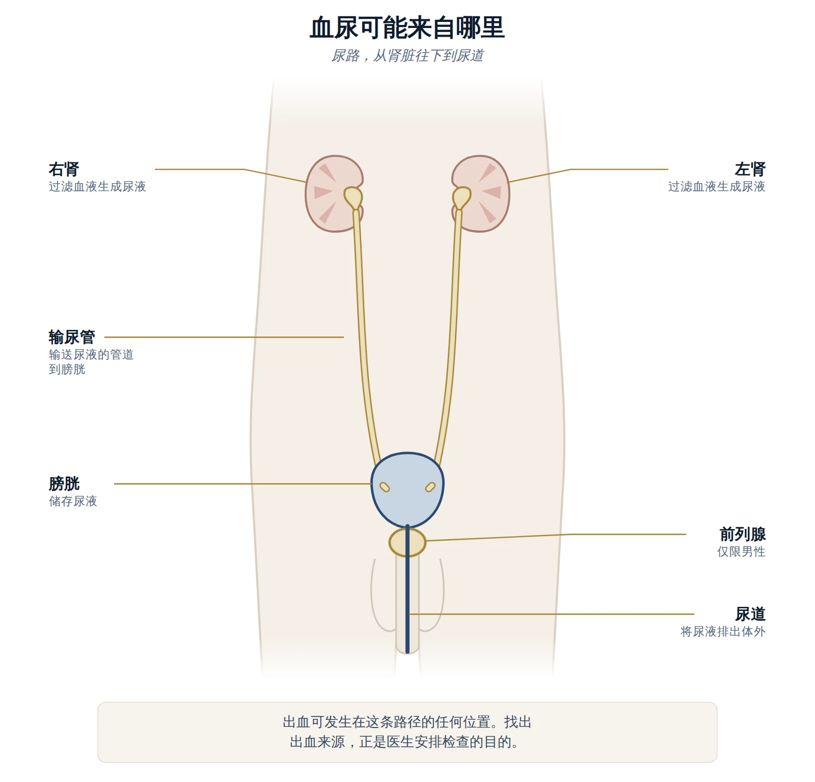 尿路示意图，显示肾脏、输尿管、膀胱、前列腺与尿道——血尿可能来自的部位。