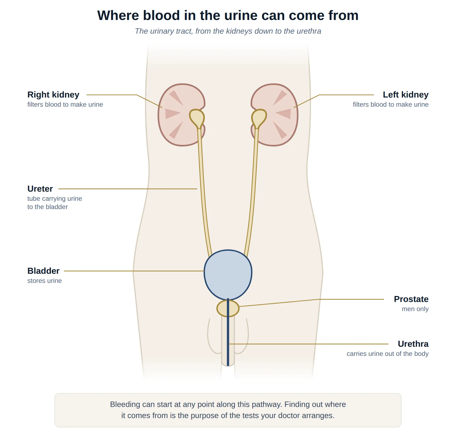 Front-view diagram of the urinary tract showing the right and left kidneys, ureters, bladder, prostate and urethra — the places where blood in the urine can come from.